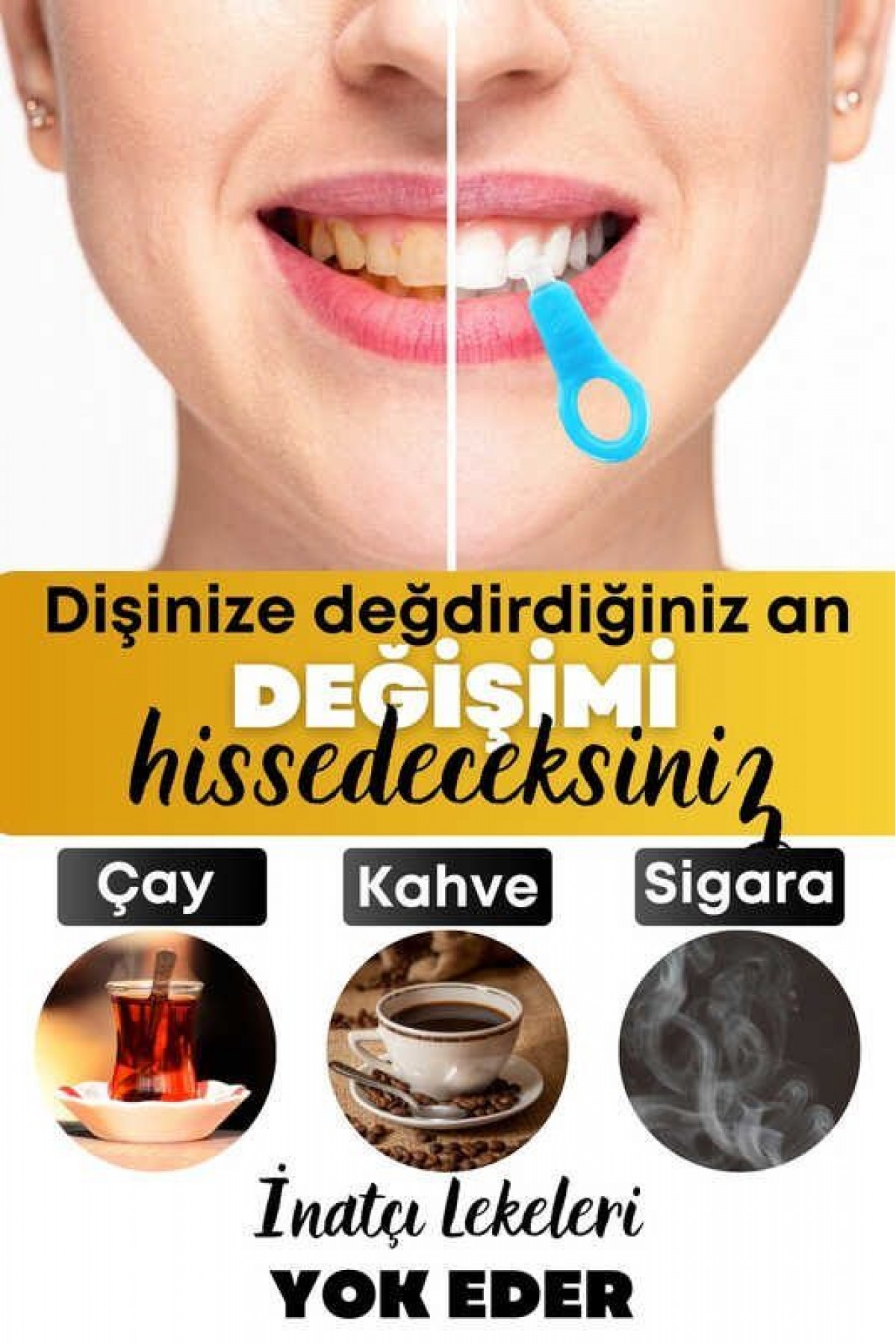 Lisinya214 Diş Leke Silgisi 1 Aparatlı + 5 Yedek Süngerli Set 1 Paket