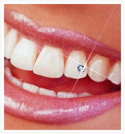 Elit Diş Kristali Ve Diş Pırlantası 5 Adet Muhteşem Gülüş Seti ( Lisinya )
