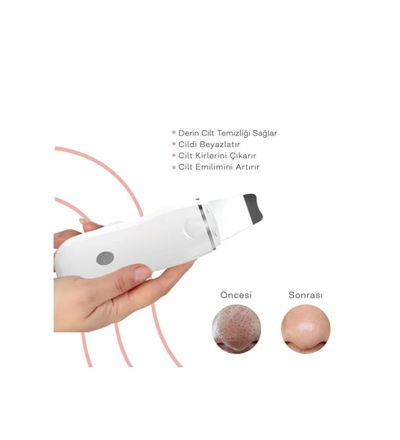 Ultrasonik Spatula Yüz Akne Giderici Siyah Nokta Temizleme Cihazı - Lisinya