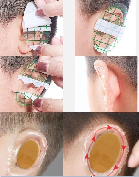 Bebek Banyo Kulak Koruyucu Bant 10 Adet ( Lisinya ) Bebek Banyo Kulak Koruyucu Bant 10 Adet ( Lisinya )