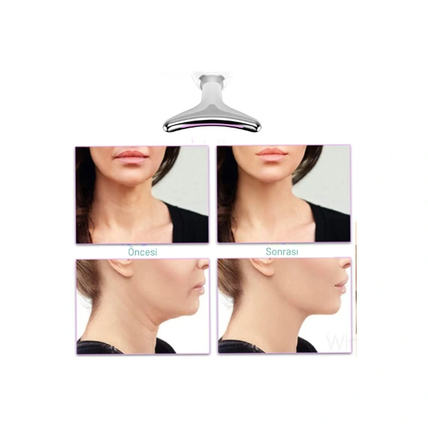 Kırışıklık Giderici Masaj Cihazı ( Lisinya ) Kırışıklık Giderici Masaj Cihazı ( Lisinya )