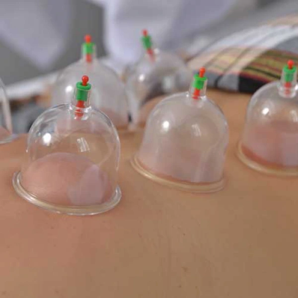 Kupa Çekme Hacamat Seti 6 Adet ( Lisinya ) Kupa Çekme Hacamat Seti 6 Adet ( Lisinya )