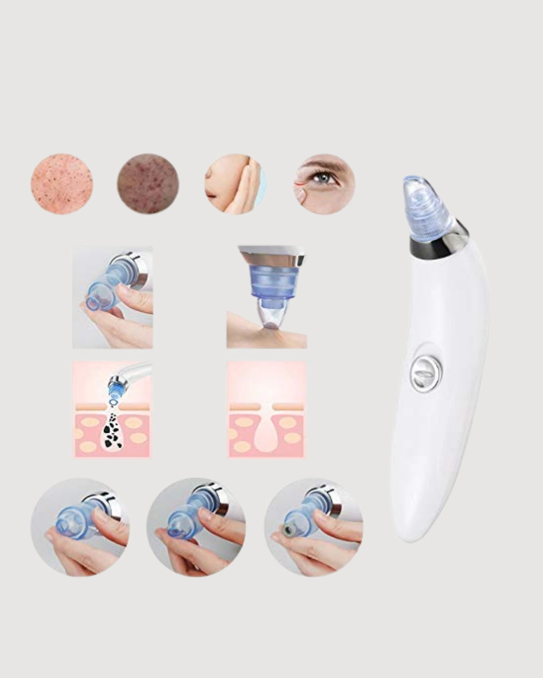 Mikro Kristal Başlıklı Siyah Nokta Temizleme Cihazı – Vakum Gücüyle Gözenek Sıkılaştırıcı ( Lisinya )