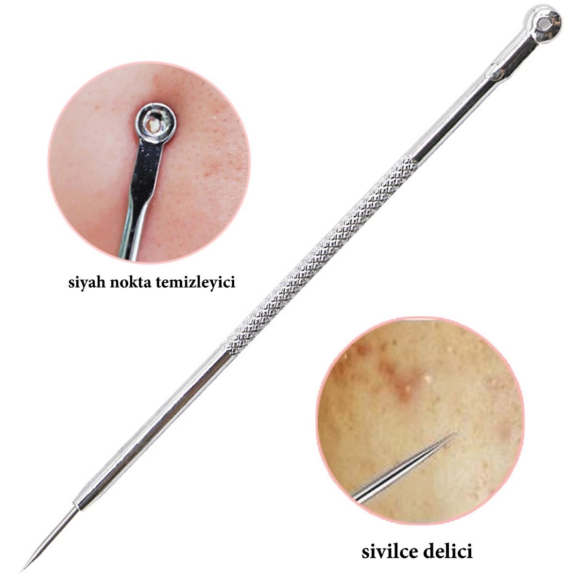 Paslanmaz Çelik Siyah Nokta Sivilce Ve Akne Temizleyici Set 3'lü Kit ( Lisinya ) Paslanmaz Çelik Siyah Nokta Sivilce Ve Akne Temizleyici Set 3'lü Kit ( Lisinya )