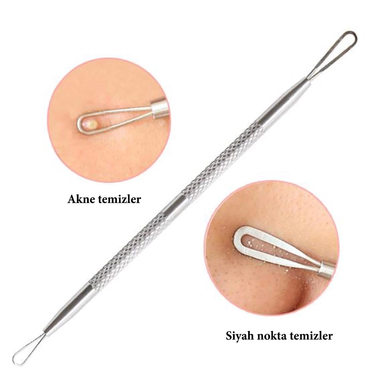 Paslanmaz Çelik Siyah Nokta Sivilce Ve Akne Temizleyici Set 3'lü Kit ( Lisinya ) Paslanmaz Çelik Siyah Nokta Sivilce Ve Akne Temizleyici Set 3'lü Kit ( Lisinya )