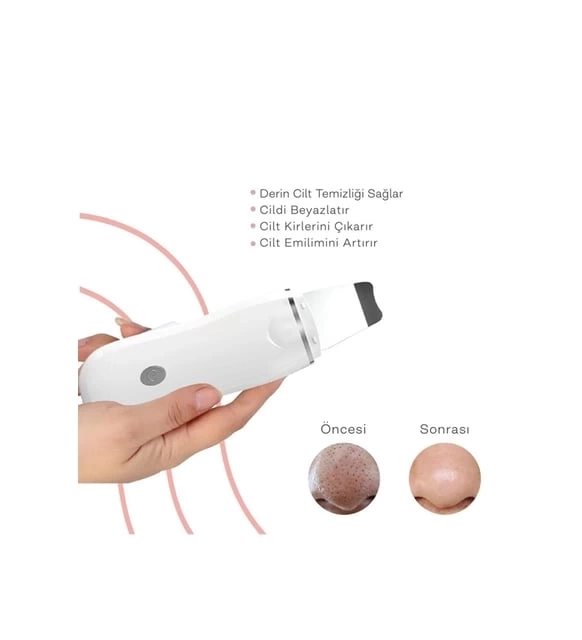 Ultrasonik Spatula Yüz Akne Giderici Siyah Nokta Temizleme Cihazı ( Lisinya )