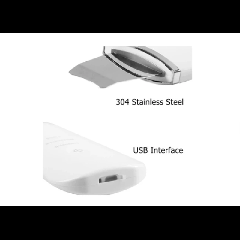 Ultrasonik Yüz Temizleme Cihazı ( Lisinya )