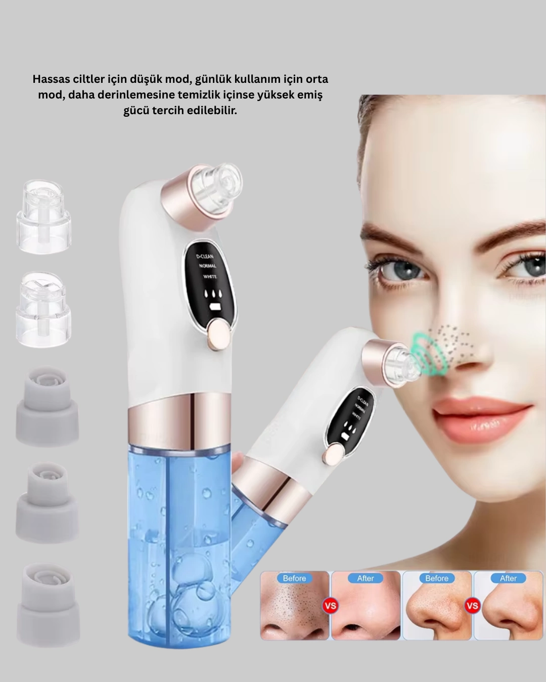 Vakum Teknolojili Siyah Nokta Temizleyici – Cilt Tonu Eşitleyen Masajlı Cilt Bakım Cihazı ( Lisinya )