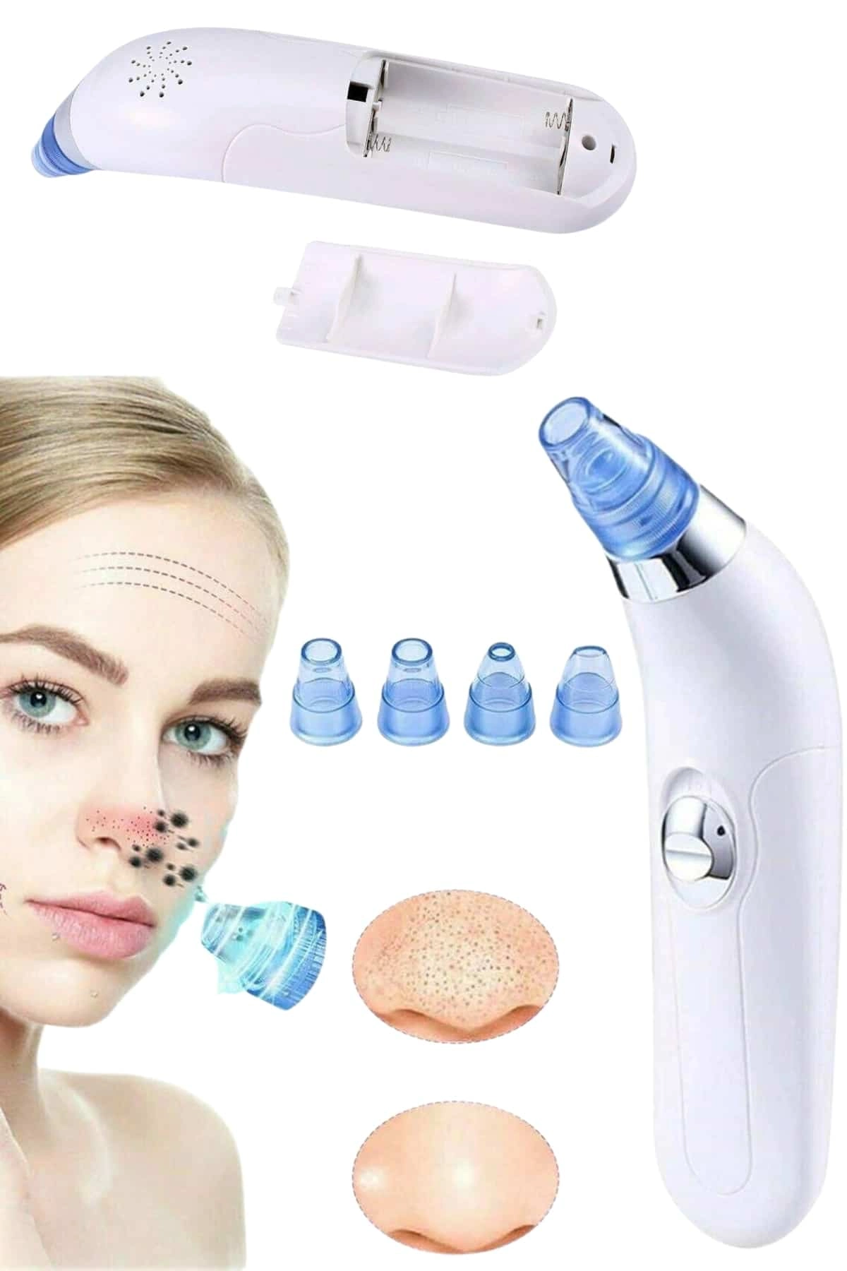 Vakumlu Siyah Nokta Ve Yüz Temizleme Cihazı 4 Başlıklı ( Lisinya )