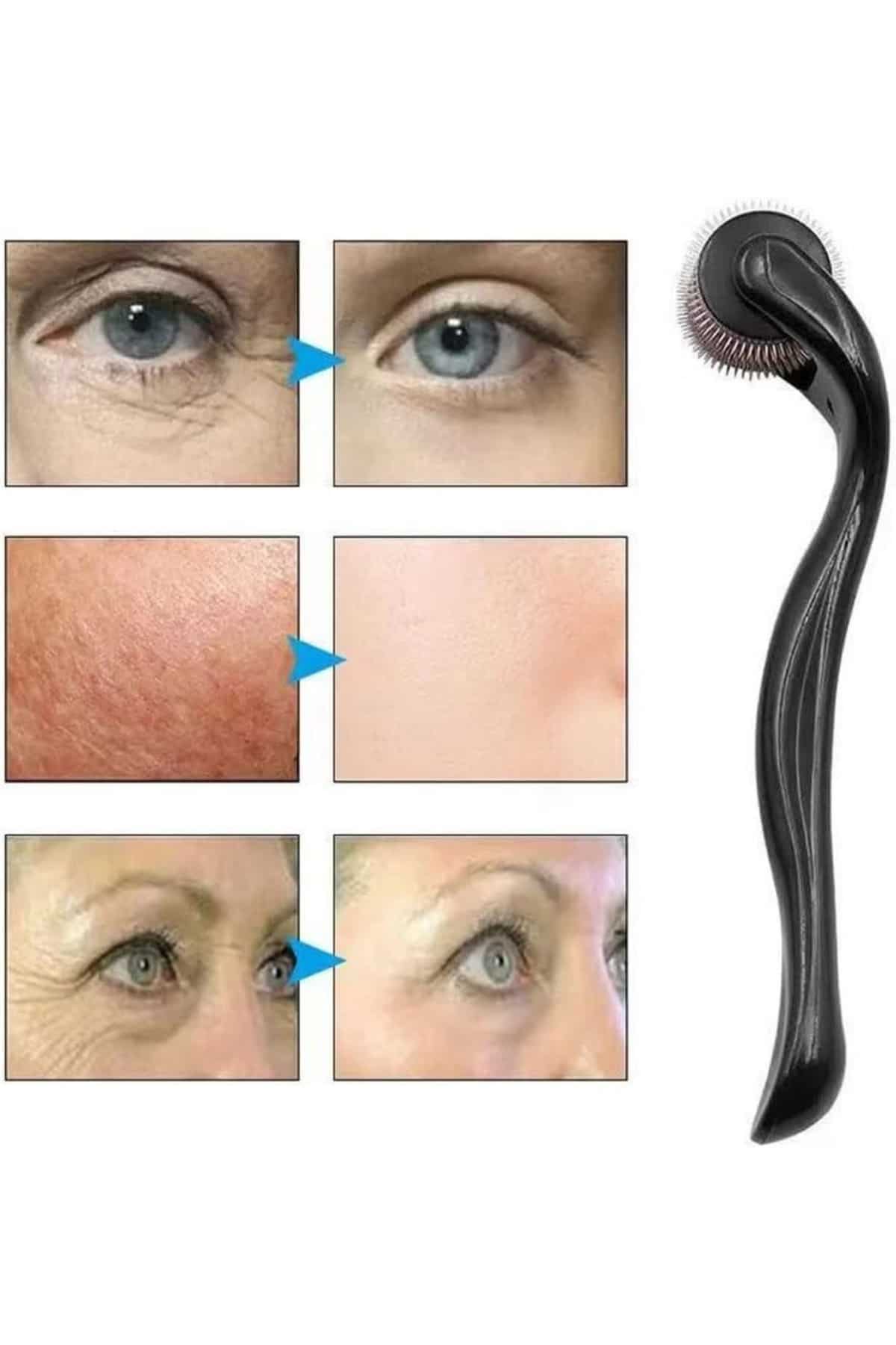 Dermaroller Titanyum 540 Iğneli 1 Mm Saç Kaş Sakal Serum Kullanıma Uygun - Lisinya