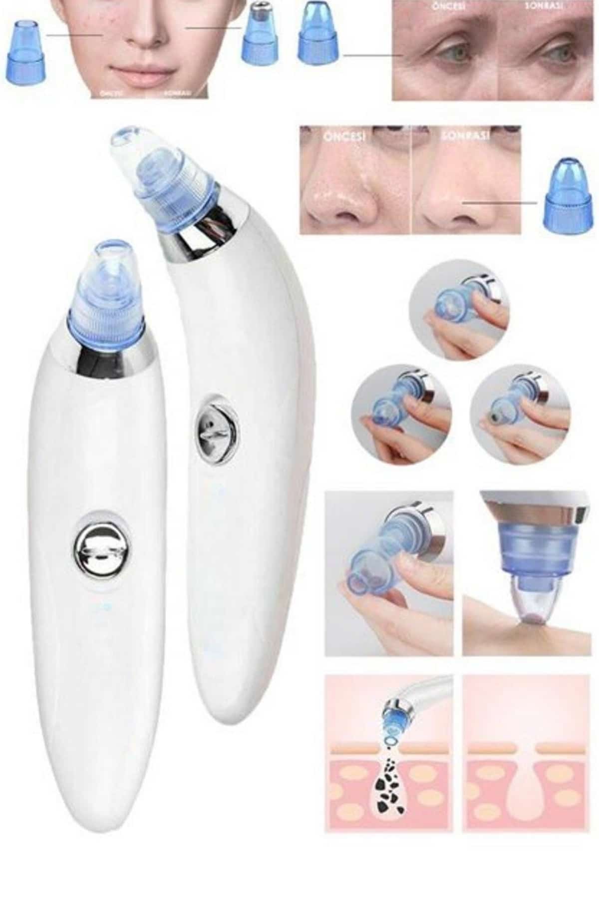 Vakumlu Siyah Nokta Ve Yüz Temizleme Cihazı 4 Başlıklı - Lisinya