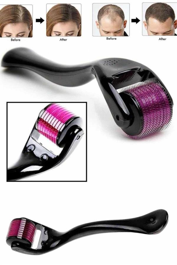 Derma Roller Titanyum Uçlu 540 İğneli 1 Mm Saç Sakal Çıkarma Ve Cilt Bakım Masaj Aleti - Lisinya