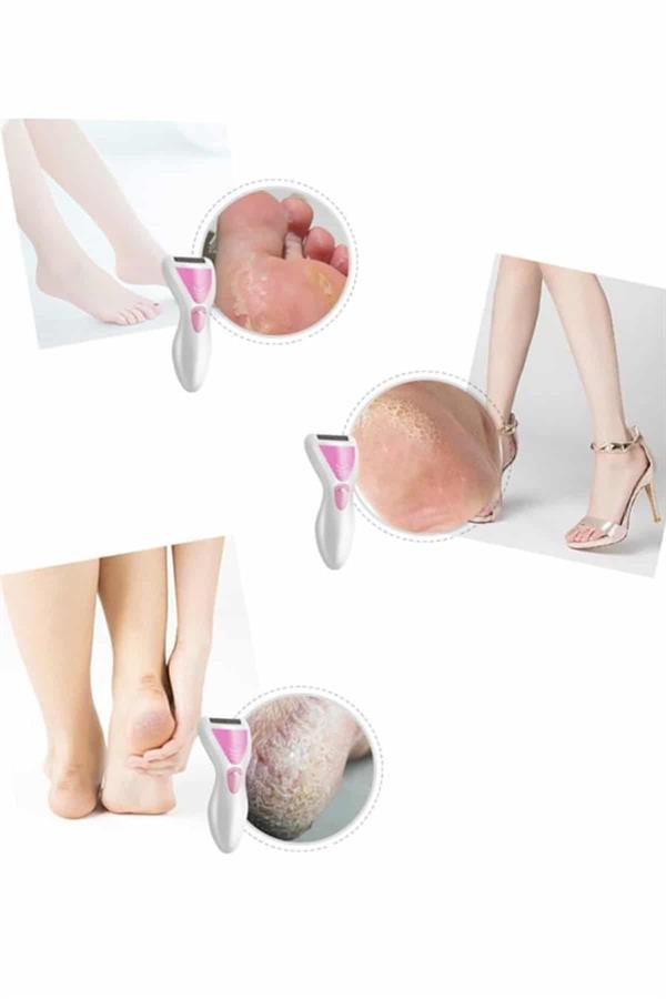 Epilatör Cihazı Epilasyon Aleti Çoklu Başlık Seçeneği Ayak Törpüsü - Lisinya