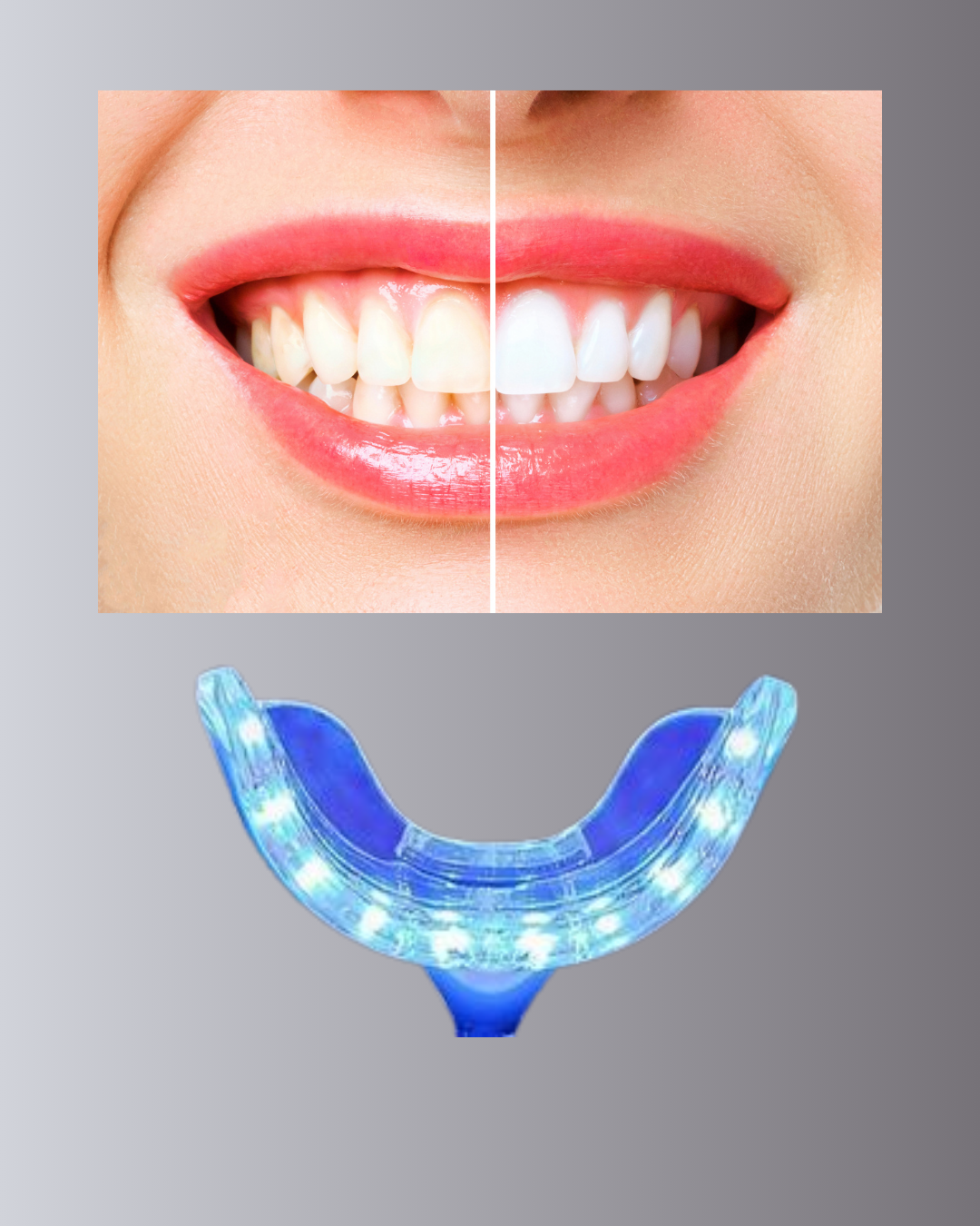 20 Dakikada Hızlı Etkili Diş Beyazlatıcı Cihaz - Lisinya