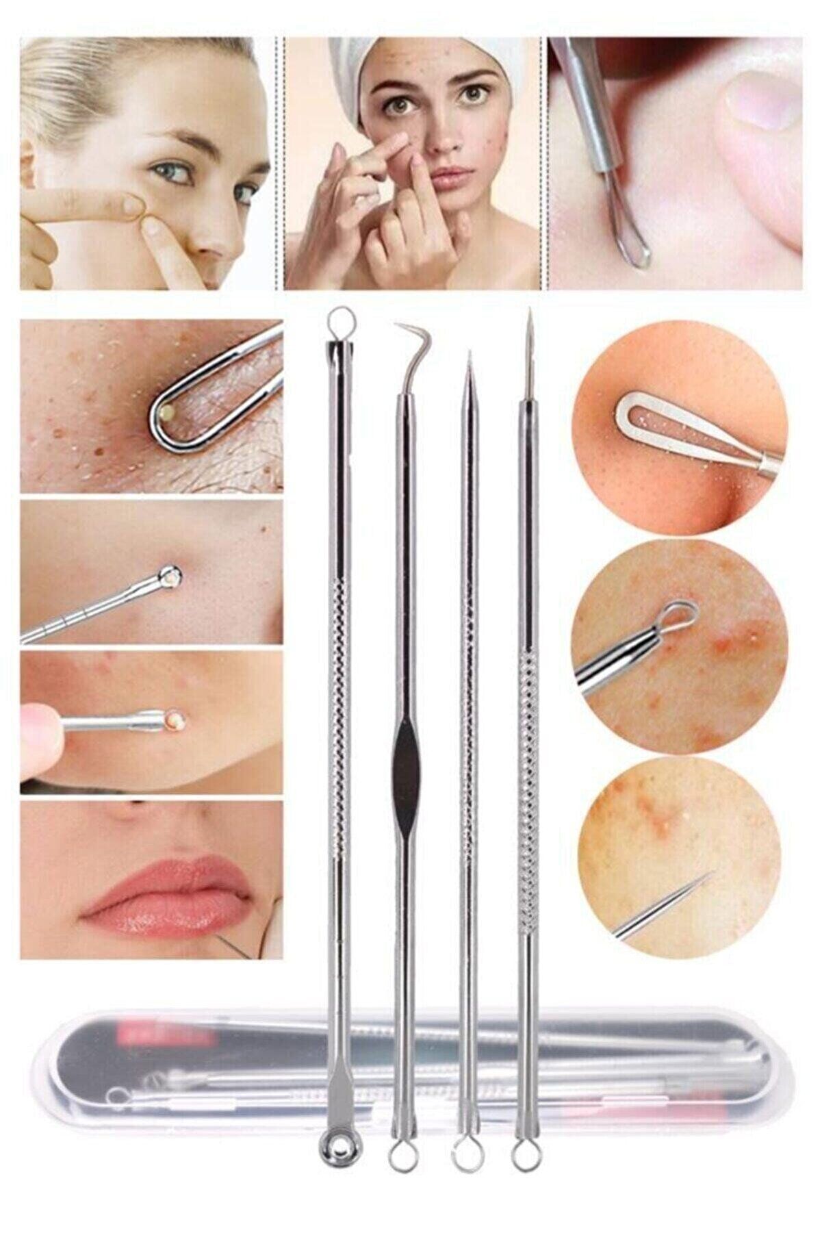 4 lü Kutulu Paslanmaz Komedon Akne - Siyah Nokta Temizleyici Set - Lisinya