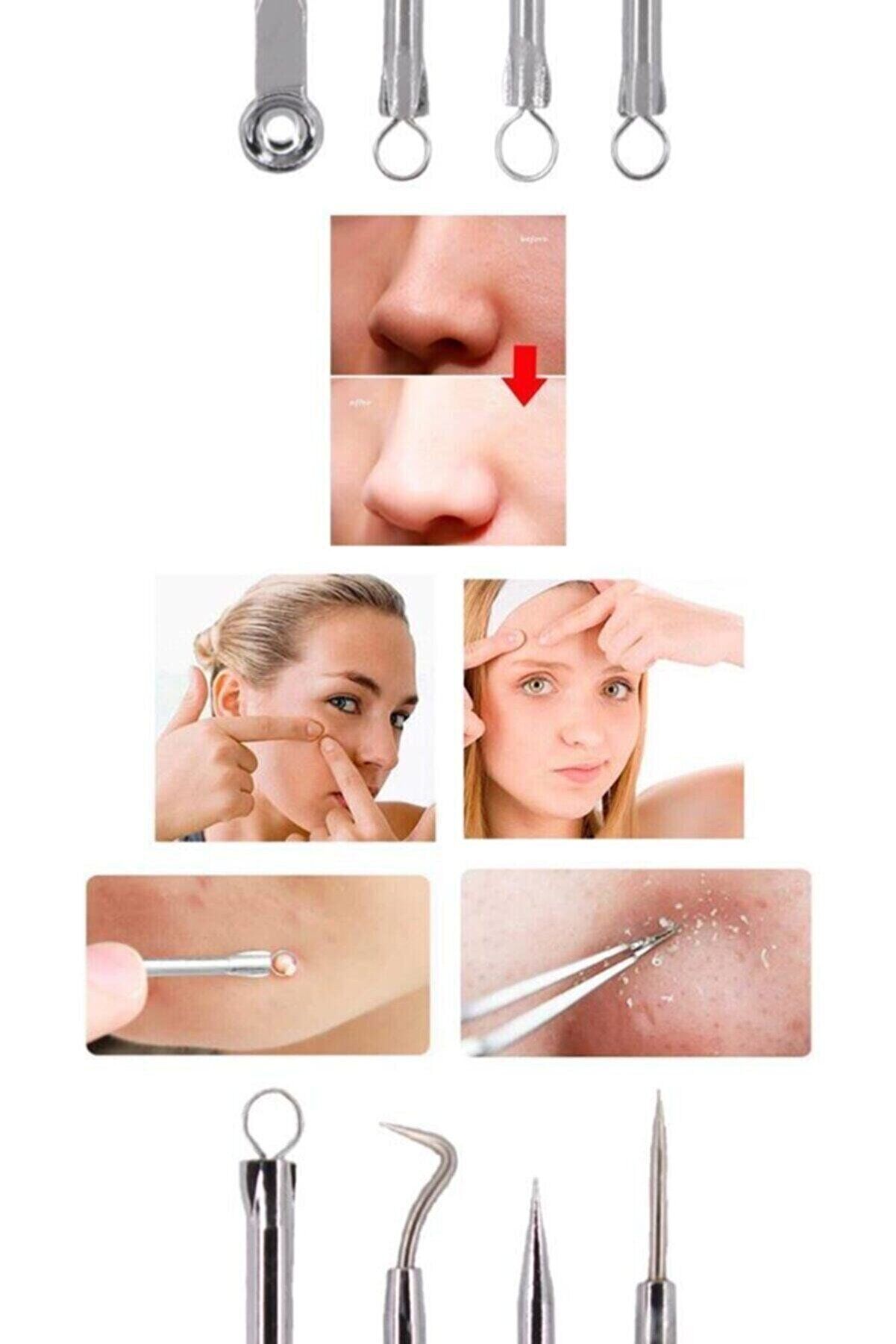 4 lü Kutulu Paslanmaz Komedon Akne - Siyah Nokta Temizleyici Set - Lisinya